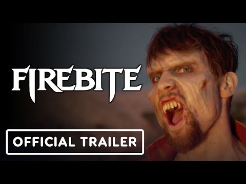 Review: Firebite S1 Ep1 | Surgeons of Horror