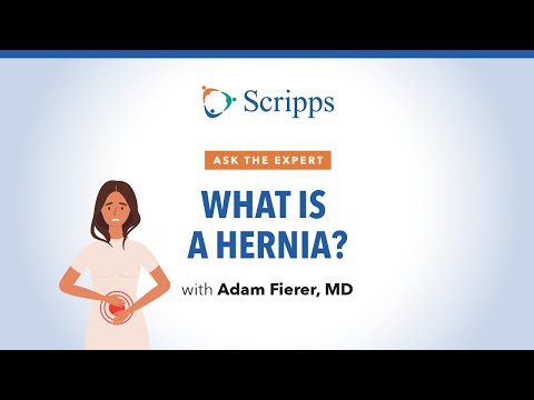 Causes, Symptoms and Treatment for Hernias | Ask The Expert