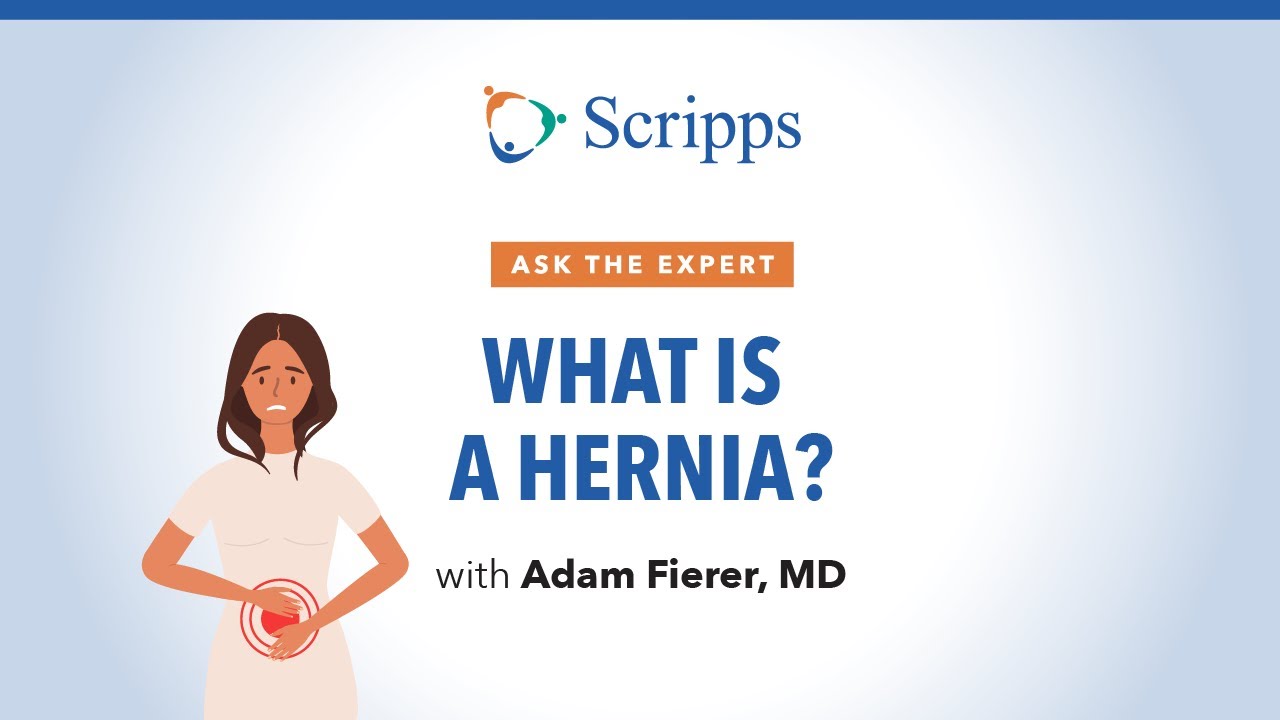 Causes, Symptoms and Treatment for Hernias | Ask The Expert