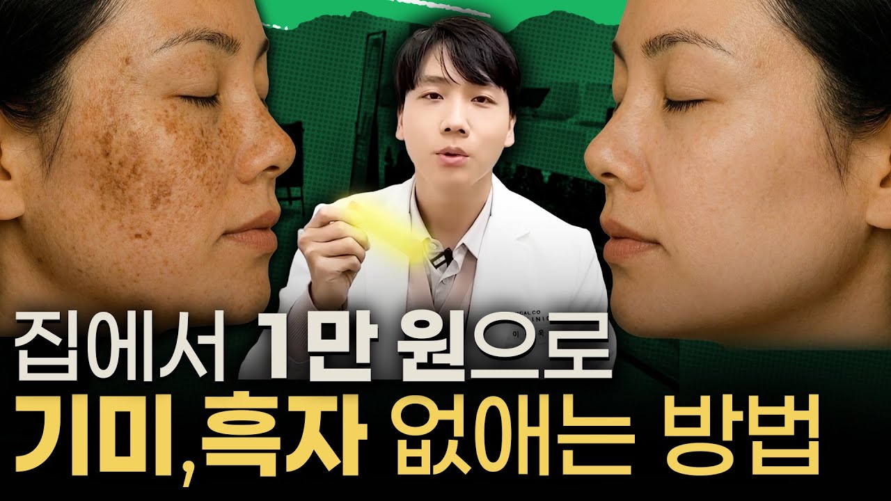 피부과 먼저 가지마세요… 단돈 1만원으로 기미, 흑자 없애는 방법 공개!