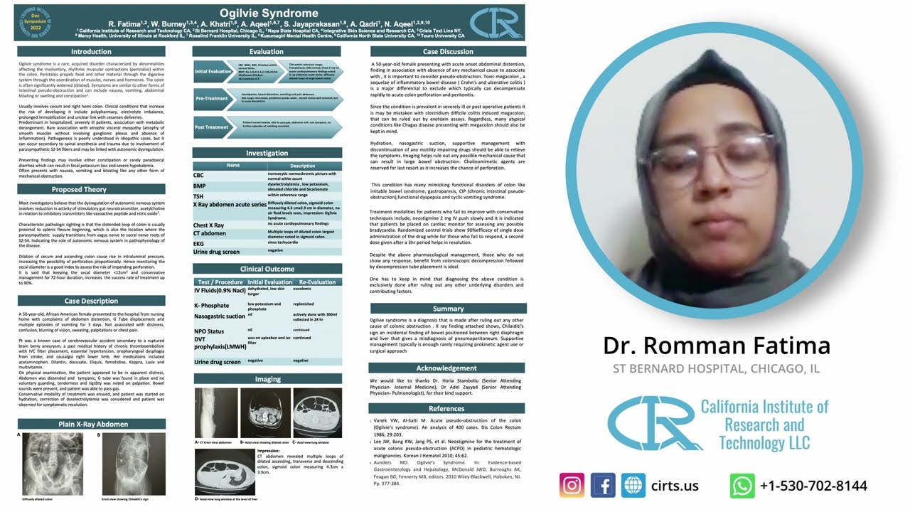 Ogilvie Syndrome - Dr. Romman Fatima