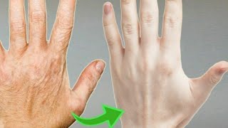 How  To Make Your Hands Look 5 Years Younger! Wrinkle Free Smooth Hands |Dr. Vivek Joshi