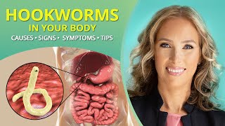Hookworms | Causes, Signs, Symptoms, &amp; Tips #parasites | Dr. J9 Live