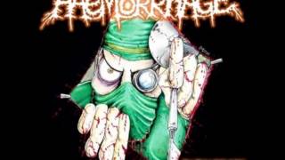Haemorrhage - Slithering Maceration of Ulcerous Facial Tissue (General Surgery cover)