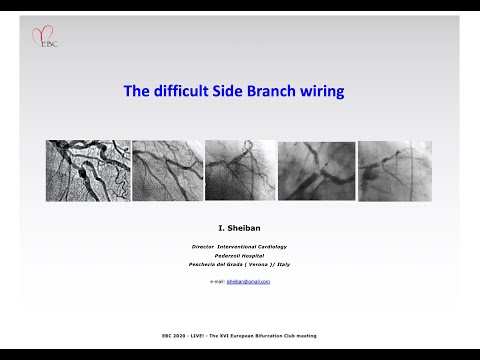 Difficult Side Branch Wiring - Prof Imad Sheiban