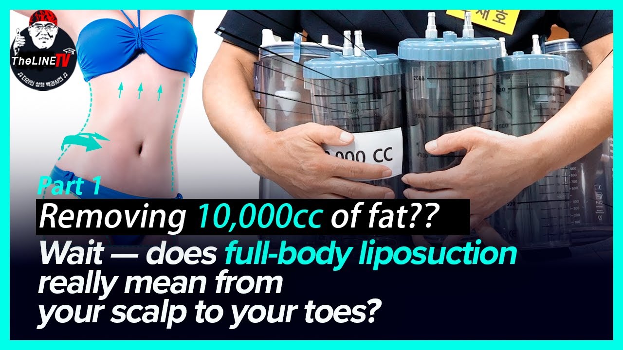 Which areas are included when we talk about full-body liposuction? - TheLINE Plastic Surgery video