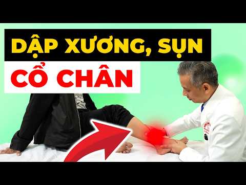 Dập Xương Dập Sụn Cổ Chân Do Chấn Thương: Đừng Chủ Quan