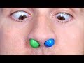 M&M'S STUCK IN NOSE! M&M'S STUCK IN NOSE!