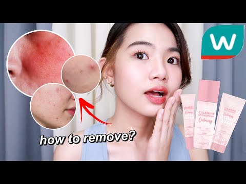 fresh calamine toner ingredients