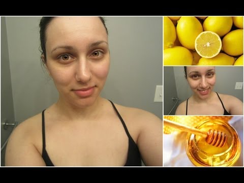 Honey Face Mask For Acne Scars & Dark Spots