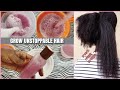 ONIONS GREW HER HAIR EXCESSIVELY Natural Hair Growth Treatment Shivan Kay