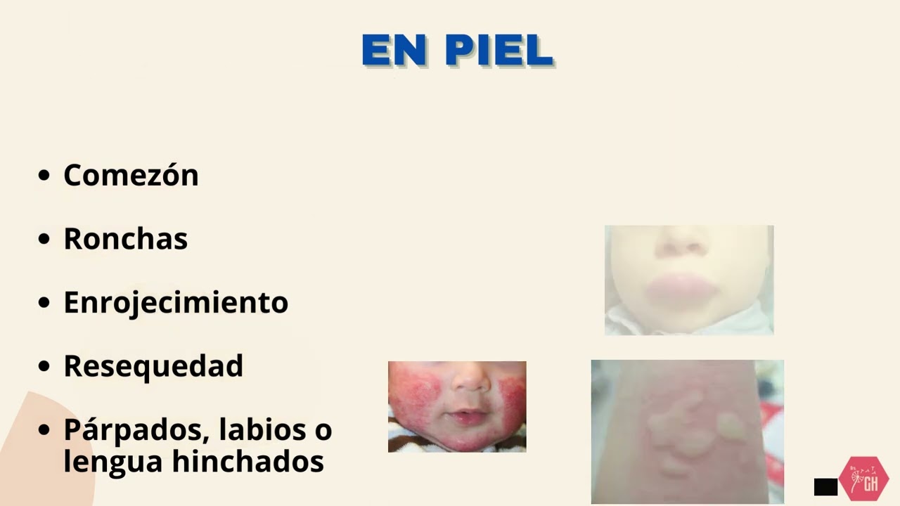 Gisela Herrera Escalante-10