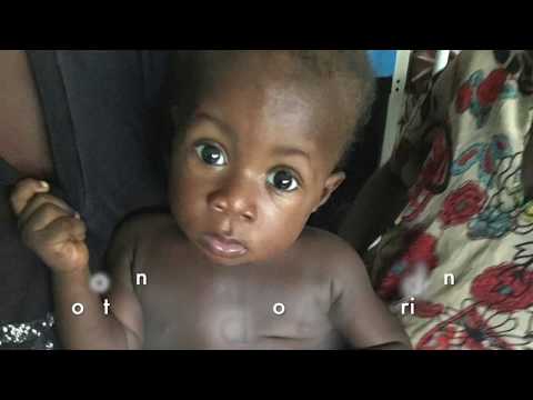 Life-saving surgery for 24 children in S.E Nigeria
