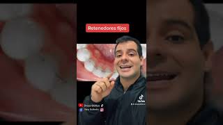 ✅ Retenedores fijos en ortodoncia 🤔| Diego Ubillús