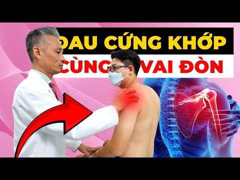 Đau Cứng Khớp Cùng Vai Đòn Khiến Bạn Mất Ngủ? Cách Điều Trị Hiệu Quả