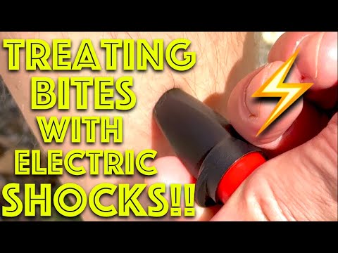 Do Electric Shocks REALLY stop insect bites itching?? Expedition medication -  Dr Gill