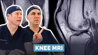 Understanding Your Knee MRI Report. We Break Down Every Word