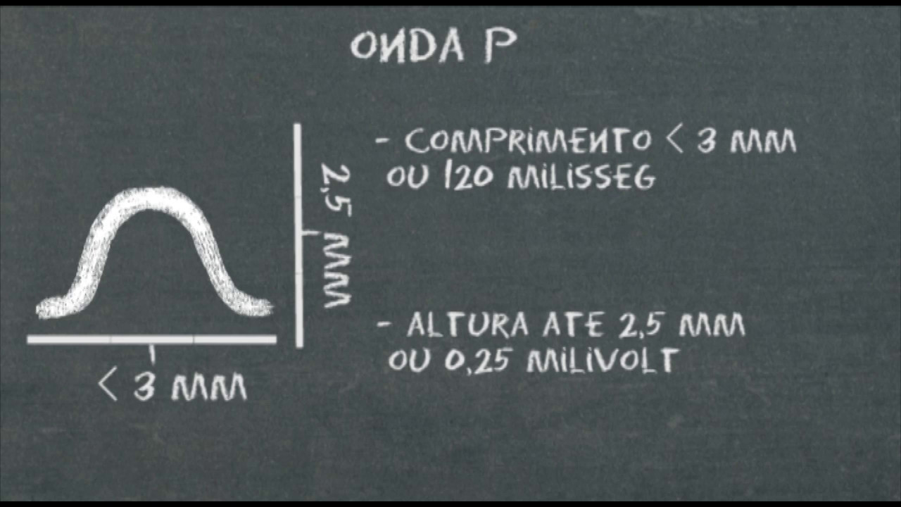 Eletrocardiograma em 5 passos