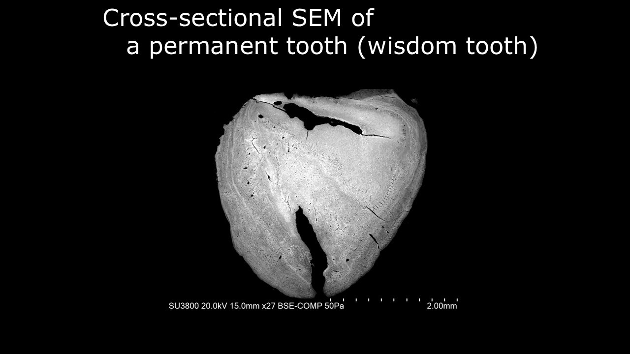 [Life] Cross-sectional SEM of a permanent tooth (wisdom tooth)
