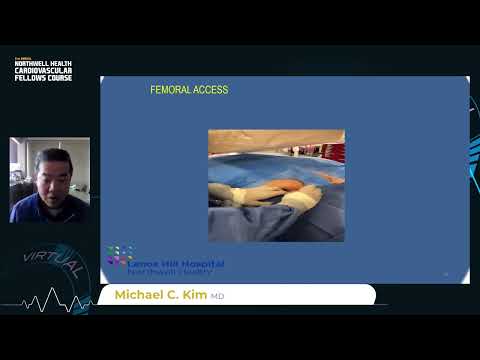 Femoral Access With Ultrasound Guided approach in PCI/angiogram with Video Demo, lecture