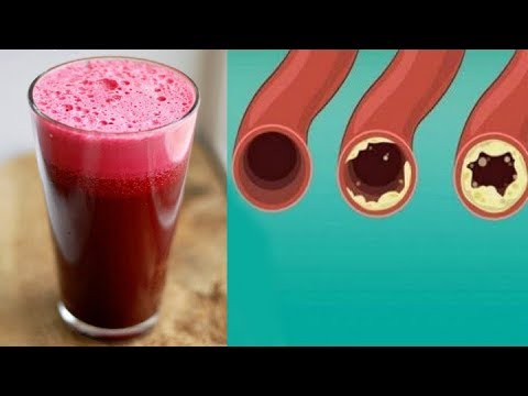 Lower Your Cholesterol In No Time By Just Eating These Foods