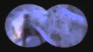 Belasco - Chloroform