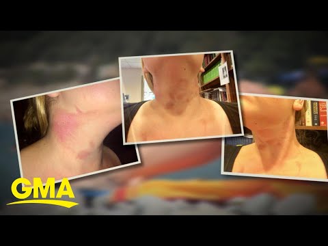 download lagu mp3 mp4 Lemon Lime Labor Aid, download lagu Lemon Lime Labor Aid gratis, unduh video klip Lemon Lime Labor Aid