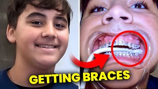 Patient getting BRACES on…full process | McKinney Orthodontist