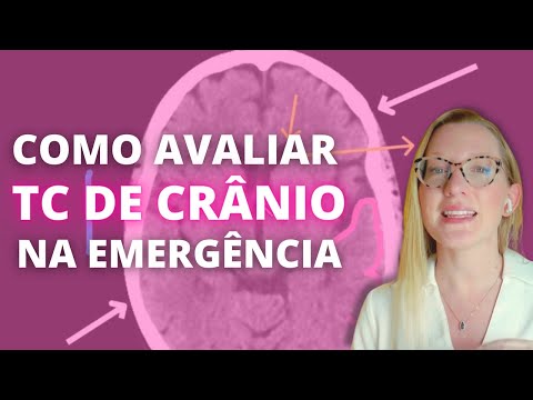 How to evaluate a cranial CT scan in the emergency room: step by step.
