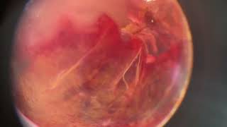 Russian Baths – “Hunger”