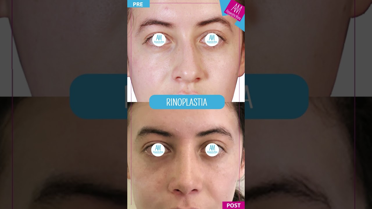 Alexandra Mora Hernandez-118