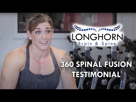 Longhorn Brain and Spine - 360 Spinal Fusion Patient Testimonial