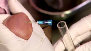 Newborn Care: Taking a Venous Blood Sample