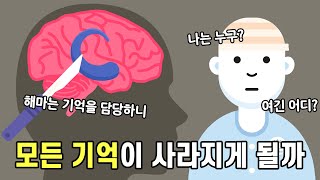 해마를 제거하면 어떻게 될까