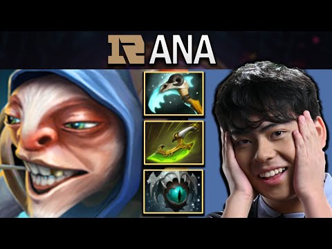 Meepo Dota 2 Gameplay RNG.Ana with Swift Blink - Skadi - 1000 GPM #dota #dota2