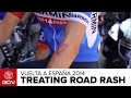 How To Treat Road Rash Vuelta A España 2014