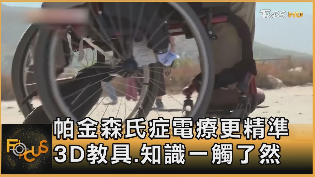 帕金森氏症電療更精準　3D教具.知識一觸了然