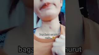 Download lagu Bekas Digigit Nyamuk Kali ya #shorts #tiktok #viral #lucu mp3