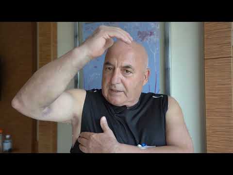 KOLTUK ALTI 3 KAPAK AMELİYATI..