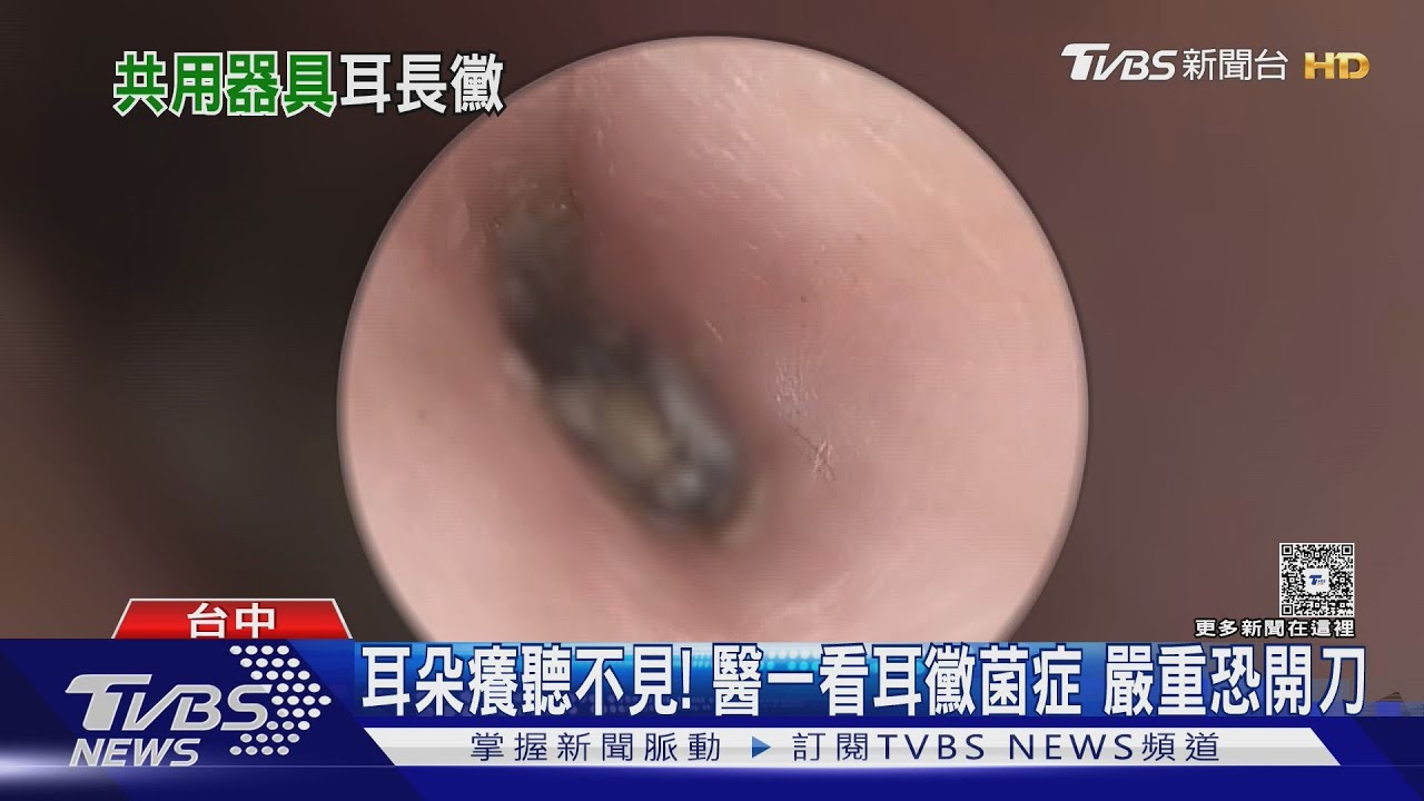 「酥麻感」台中男迷上越式洗頭"采耳" 耳道長霉求助