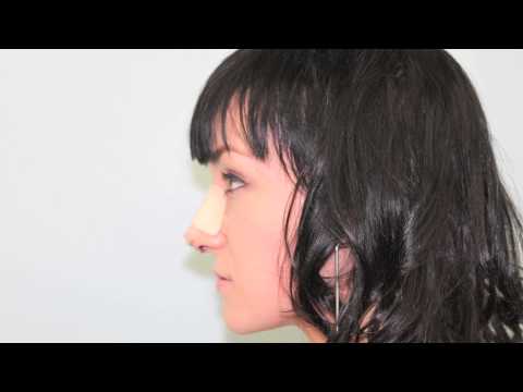 YouTube video about: How to get time off work for cosmetic surgery?