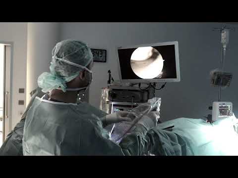 Aufgrund zervikale Osteoarthritis Temperatur sein kann Gelenke während der Menopause Volksmedizin zur Behandlung von