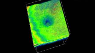 OCT de nervio óptico