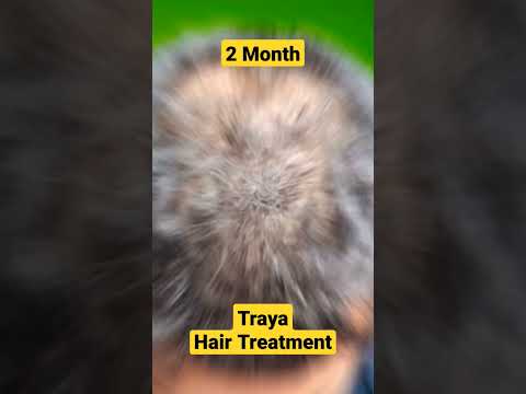 traya hair review #traya #trayahairkit