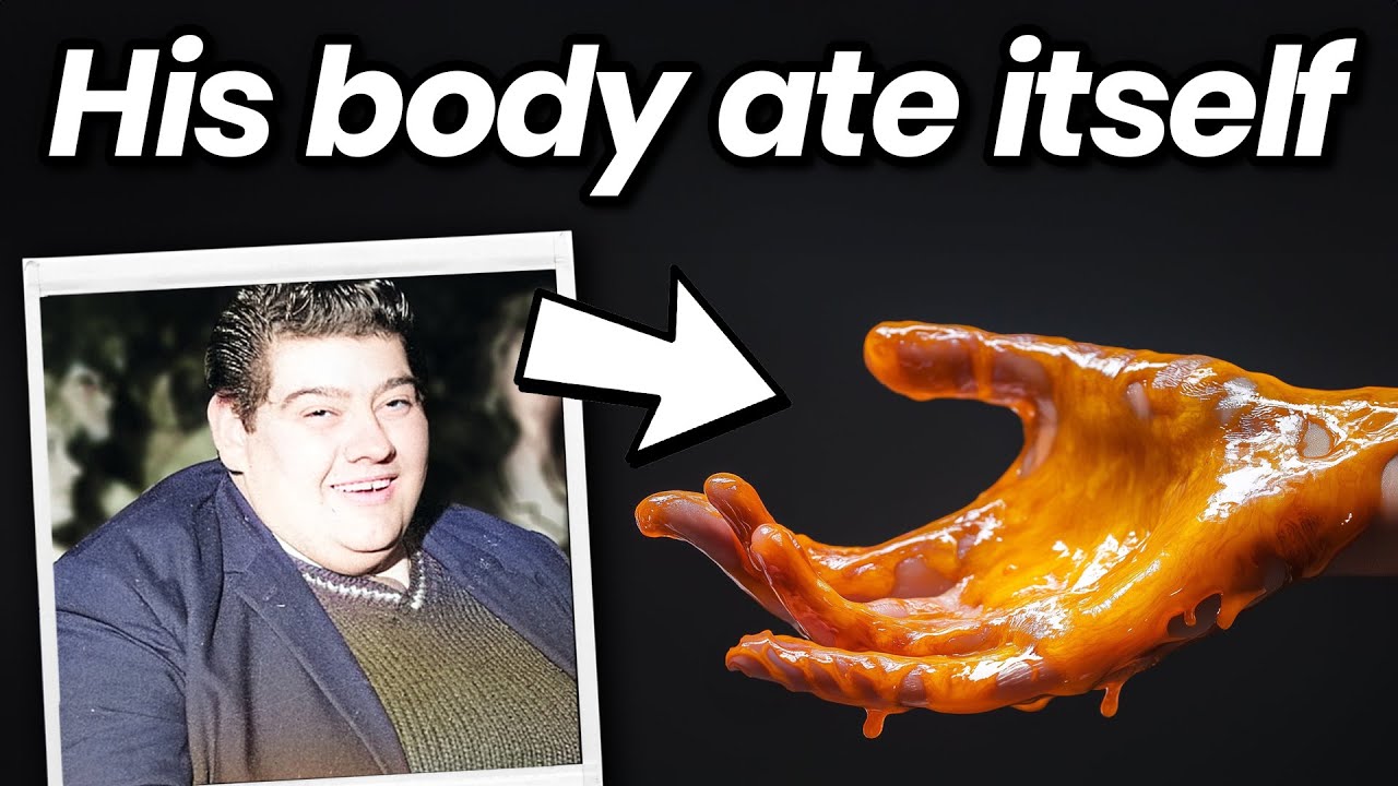 How a Man Lost 275 Pounds by Letting His Body Eat Itself