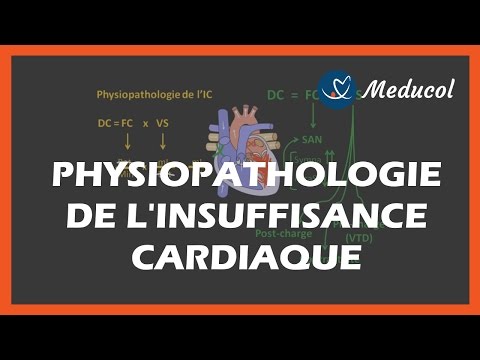 Quest-ce que lestomac portail de lhypertension Lhypertension et la conscription