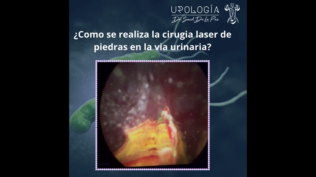 Said De La Paz Martinez-13