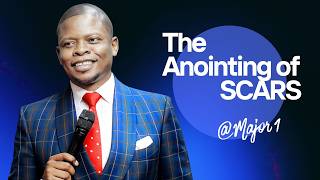 The Anointing of Scars | Prophet Shepherd Bushiri