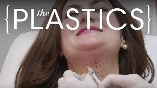 Three Ways to Permanently Remove A Double Chin | The Plastics | Harper