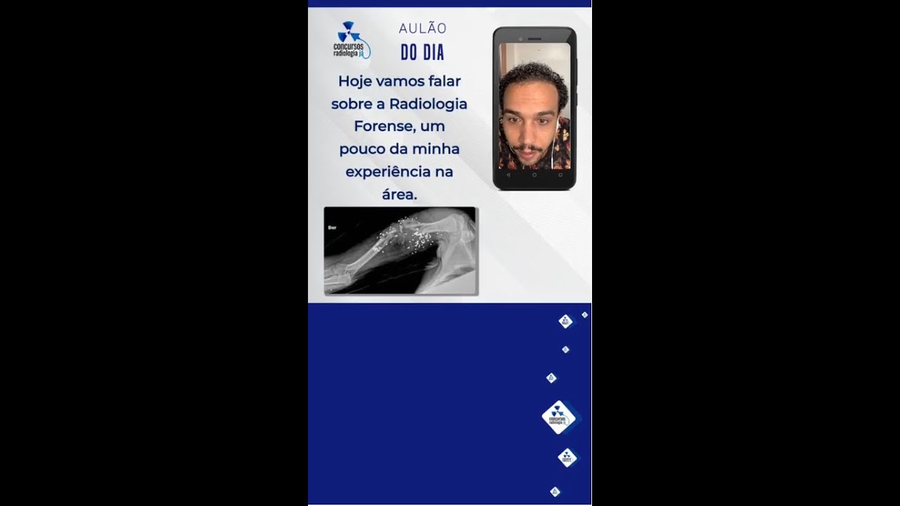 Radiologia Forense - O que você precisa saber?↴
